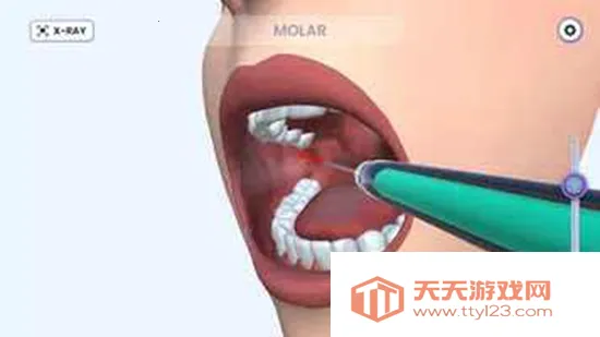 牙医模拟2025官方正版v1.0.6 手机版截图4