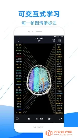 影像解剖图谱2026官方最新版本截图0